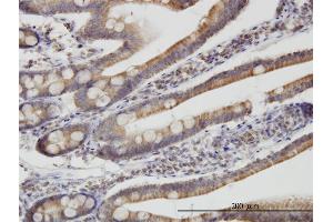 Immunostaining (ISt) image for anti-Translocase of Inner Mitochondrial Membrane 9 (TIMM9) (AA 1-89) antibody (ABIN565282)