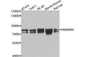 Western blot analysis of extracts of various cell lines, using HNRNPM antibody. (HNRNPM Antikörper)