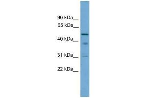 Human PANC1; WB Suggested Anti-TINAG Antibody Titration: 0. (TINAG Antikörper  (Middle Region))