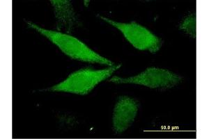 Immunofluorescence of monoclonal antibody to C1orf80 on HeLa cell. (AIDA Antikörper  (AA 1-306))