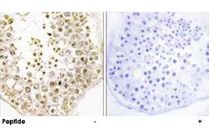 Immunohistochemistry analysis of paraffin-embedded human testis tissue, using SPZ1 polyclonal antibody . (SPZ1 Antikörper)