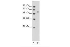 Image no. 1 for anti-Perilipin 1 (PLIN1) (AA 81-130) antibody (ABIN203499) (PLIN1 Antikörper  (AA 81-130))