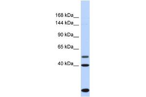 Host:  Rabbit  Target Name:  PSD3  Sample Type:  Fetal Heart lysates  Antibody Dilution:  1.