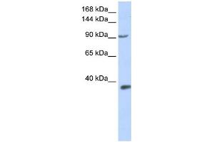WB Suggested Anti-EPAS1 Antibody Titration:  0. (EPAS1 Antikörper  (Middle Region))
