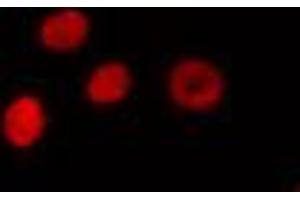 ABIN6274318 staining HuvEc cells by IF/ICC. (CSTF1 Antikörper  (N-Term))
