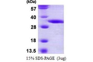 2,4-Dienoyl CoA Reductase 2, Peroxisomal (DECR2) (AA 1-292) protein (His tag)