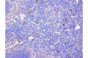 IHC analysis of CD229 using anti-CD229 antibody (ABIN6719290).