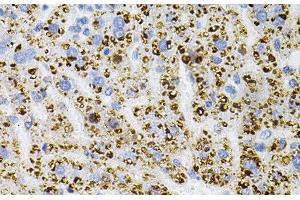Immunohistochemistry of paraffin-embedded Rat liver using NTRK1 Polyclonal Antibody at dilution of 1:100 (40x lens). (TRKA Antikörper)