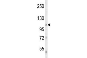 Western Blotting (WB) image for anti-Unc-51 Like Kinase 1 (ULK1) antibody (ABIN3029449)
