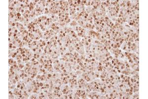 IHC-P Image Immunohistochemical analysis of paraffin-embedded BT483 xenograft, using UHRF1, antibody at 1:250 dilution. (UHRF1 Antikörper)