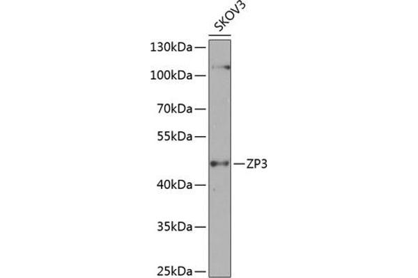 Zona Pellucida Glycoprotein 3 Antikörper  (AA 170-390)