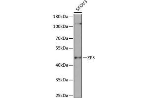 Western blot analysis of extracts of SKOV3 cells, using ZP3 antibody (ABIN6130818, ABIN6150537, ABIN6150539 and ABIN6224382) at 1:1000 dilution. (Zona Pellucida Glycoprotein 3 Antikörper  (AA 170-390))