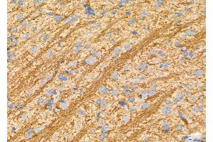 ABIN6263324 and ABIN6277538 at 1/100 staining Rat brain tissue by IHC-P.