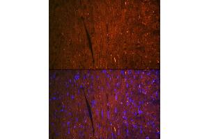 Immunofluorescence (IF) image for anti-Fatty Acid Binding Protein 3, Muscle and Heart (FABP3) antibody (ABIN7267152)