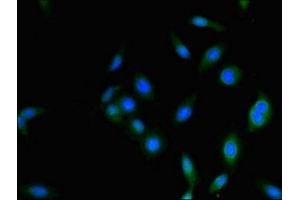 Immunofluorescence staining of Hela cells with ABIN7142208 at 1:333, counter-stained with DAPI.