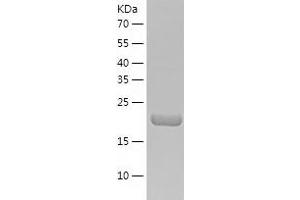 ETHE1 Protein (AA 13-254) (His tag)