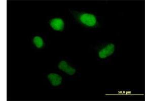 Immunofluorescence of purified MaxPab antibody to PSMB5 on HeLa cell.