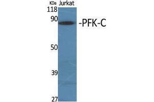 Western Blot (WB) analysis of specific cells using PFK-C Polyclonal Antibody. (PFKP Antikörper  (Internal Region))