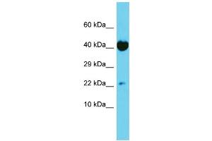 Host: Rabbit Target Name: TRAPPC6A Sample Type: HT1080 Whole Cell lysates Antibody Dilution: 1. (TRAPPC6A Antikörper  (N-Term))