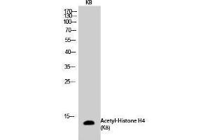 Western Blotting (WB) image for anti-Histone H4 (acLys8) antibody (ABIN3181871) (Histone H4 Antikörper  (acLys8))