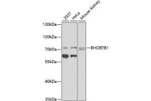 Western blot analysis of extracts of various cell lines, using RHOBTB1 antibody (ABIN6128679, ABIN6146936, ABIN6146937 and ABIN6225297) at 1:1000 dilution. (RHOBTB1 Antikörper  (AA 240-400))