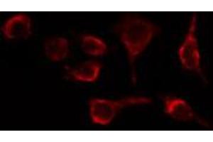 ABIN6269323 staining HeLa cells by IF/ICC. (LIPE Antikörper  (Internal Region))