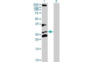 Western Blotting (WB) image for anti-Ring Finger and CHY Zinc Finger Domain Containing 1, E3 Ubiquitin Protein Ligase (RCHY1) (AA 1-252) antibody (ABIN525493)