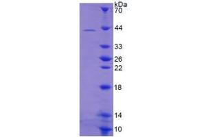 Image no. 1 for Defensin, alpha 1B (DEFA1B) (AA 20-94) protein (His tag,GST tag) (ABIN6237824) (DEFA1B Protein (AA 20-94) (His tag,GST tag))