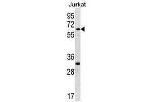 SMARCD1 Antibody (C-term) western blot analysis in Jurkat cell line lysates (35µg/lane). (SMARCD1 Antikörper  (C-Term))