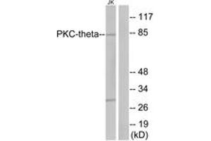 Western blot analysis of extracts from Jurkat cells, treated with PMA 200nM 30', using PKC thet (Ab-676) Antibody. (PKC theta Antikörper  (AA 643-692))