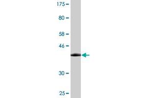 Western Blot detection against Immunogen (35. (VCP Antikörper  (AA 221-310))