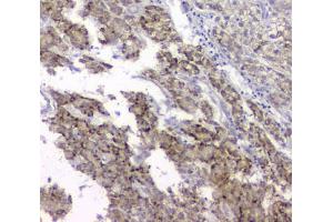 IHC analysis of TIMM17A using anti-TIMM17A antibody (ABIN6719637). (TIMM17A Antikörper)