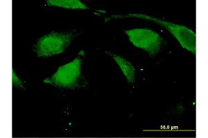 Immunofluorescence of monoclonal antibody to DAZAP2 on HeLa cell. (DAZAP2 Antikörper  (AA 93-168))