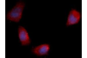 Immunofluorescence (IF) image for anti-Fibroblast Growth Factor 12 (FGF12) (AA 1-181) antibody (PE) (ABIN5565468)
