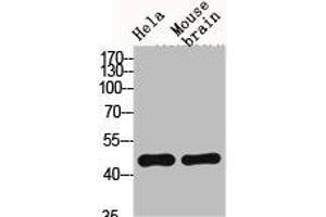 Western Blot analysis of HELA MOUSE-BRAIN cells using Fusin Polyclonal Antibody (CXCR4 Antikörper  (C-Term))
