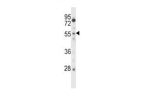 CSRNP2 Antibody (C-term) (ABIN657400 and ABIN2846440) western blot analysis in CEM cell line lysates (35 μg/lane). (CSRNP2 Antikörper  (C-Term))