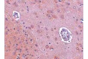 Immunohistochemical staining of rat brain tissue with 2. (FAM120A Antikörper  (Internal Region))