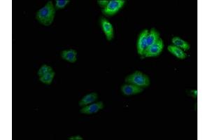 Immunofluorescence staining of HepG2 cells with ABIN7169938 at 1:100, counter-stained with DAPI. (SCN4B Antikörper  (AA 31-162))