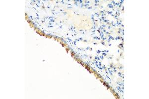 Immunohistochemistry of paraffin-embedded mouse lung using CBL antibody (ABIN6131302, ABIN6138002, ABIN6138004 and ABIN6213970) at dilution of 1:200 (40x lens). (CBL Antikörper  (AA 637-906))