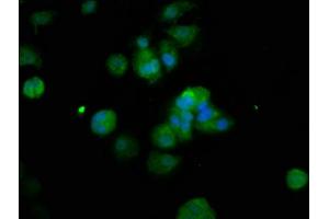 Immunofluorescence staining of MCF-7 cells with ABIN7150380 at 1:200, counter-stained with DAPI. (RFX2 Antikörper  (AA 1-130))