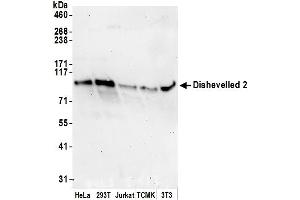 Western Blotting (WB) image for anti-Dishevelled, Dsh Homolog 2 (Drosophila) (DVL2) (AA 175-225) antibody (ABIN7451737)