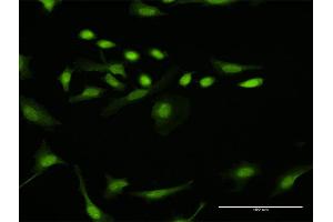 Immunofluorescence of purified MaxPab antibody to DTL on HeLa cell. (CDT2/RAMP Antikörper  (AA 1-730))