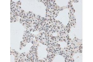 Immunohistochemistry of paraffin-embedded Rat lung using ZNF148 Polyclonal Antibody at dilution of 1:100 (40x lens).