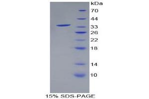 SDS-PAGE (SDS) image for Hydroxysteroid (17-Beta) Dehydrogenase 1 (HSD17B1) (AA 4-289) protein (His tag) (ABIN1879317)