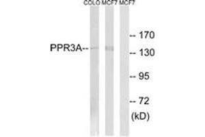 Western Blotting (WB) image for anti-Protein Phosphatase 1, Regulatory Subunit 3A (PPP1R3A) (AA 647-696) antibody (ABIN2890542) (PPP1R3A Antikörper  (AA 647-696))