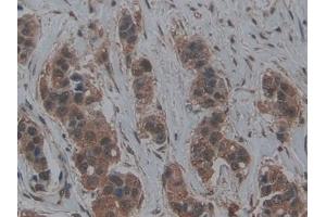 Immunohistochemistry (IHC) image for anti-Lymphotoxin beta Receptor (TNFR Superfamily, Member 3) (LTBR) (AA 66-215) antibody (ABIN7437122)