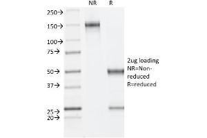 SDS-PAGE Analysis Purified ER-beta Mouse Monoclonal Antibody (ESR2/686). (ESR2 Antikörper  (C-Term))
