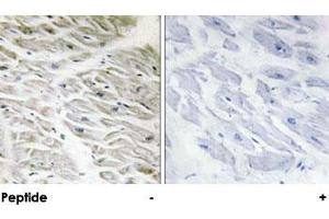 Immunohistochemical analysis of paraffin-embedded human heart tissue using PPP1R14A polyclonal antibody . (CPI-17 Antikörper)
