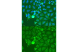 Immunofluorescence analysis of A549 cells using IRAK2 antibody (ABIN5975418). (IRAK2 Antikörper)