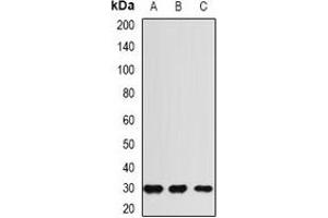 Western blot analysis of RGR expression in HEK293T (A), mouse liver (B), rat heart (C) whole cell lysates.